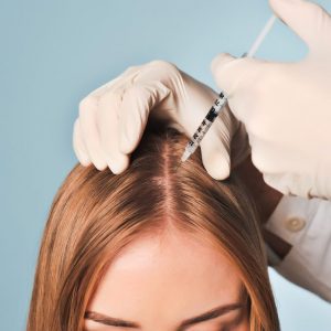 PRP Therapy For Hair