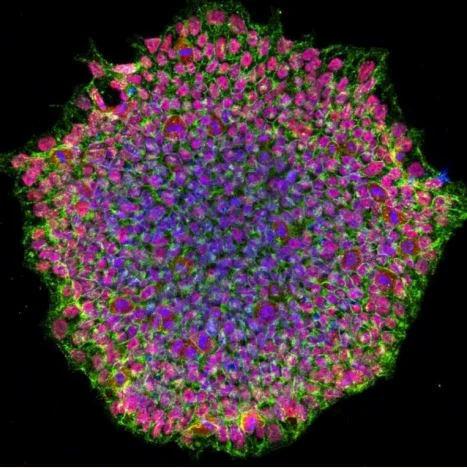 pluripotent stem cells