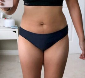weightloss2
